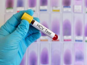 Test HCV